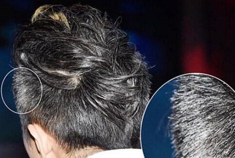 古芳栢草:年轻人长白发是什么原因?