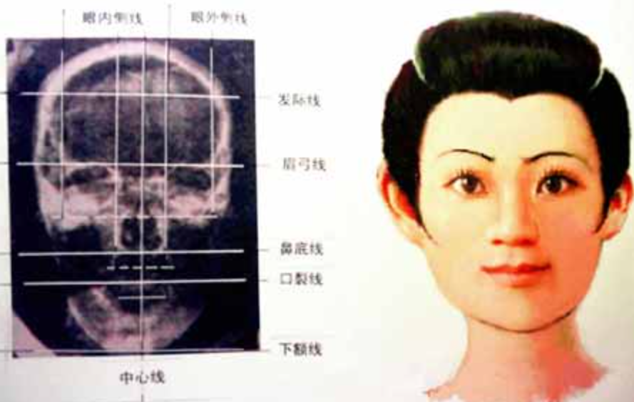 1972年,彭隆祥提出自己主刀,解剖一具出土2000年前女尸