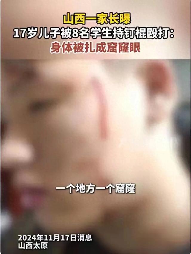 校园暴力何时休?17岁男生被8名同学持铁棍殴打,家长拒绝和解