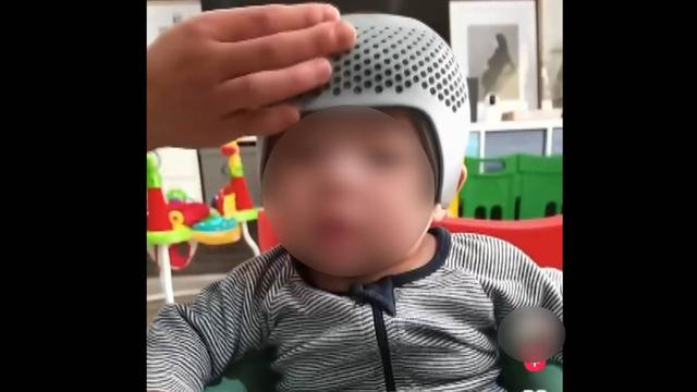 2.8万元矫正型"头盔",究竟是不是智商税?家长们看过来