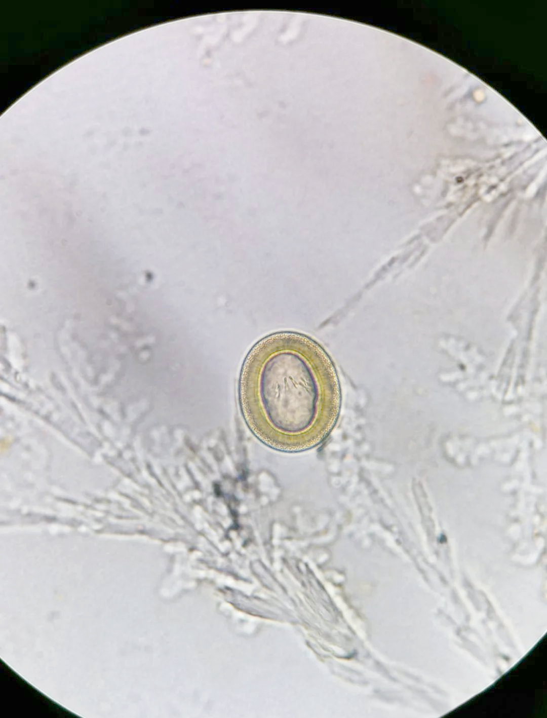 经过初步判断,这条"面条"状的寄生虫可能属于绦虫类