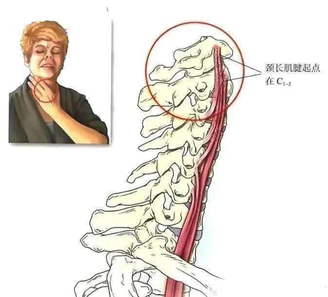 06颈胸椎棘突间滑囊炎 临床综合征 颈椎下部和胸椎上部的棘突间韧带