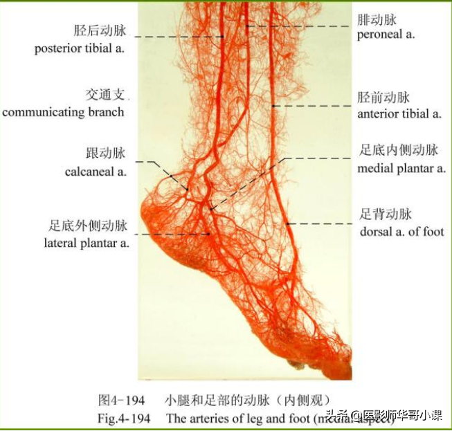 足部血管解剖,非增强足血管磁共振扫描