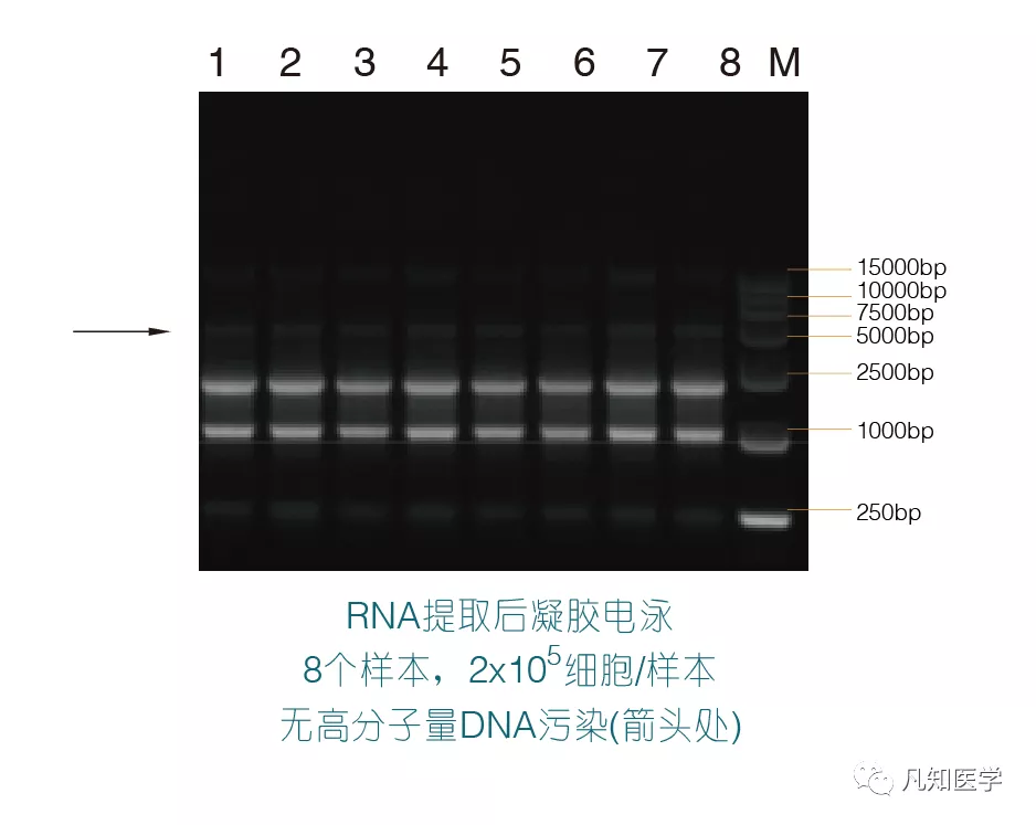 双向琼脂扩散结果图图片