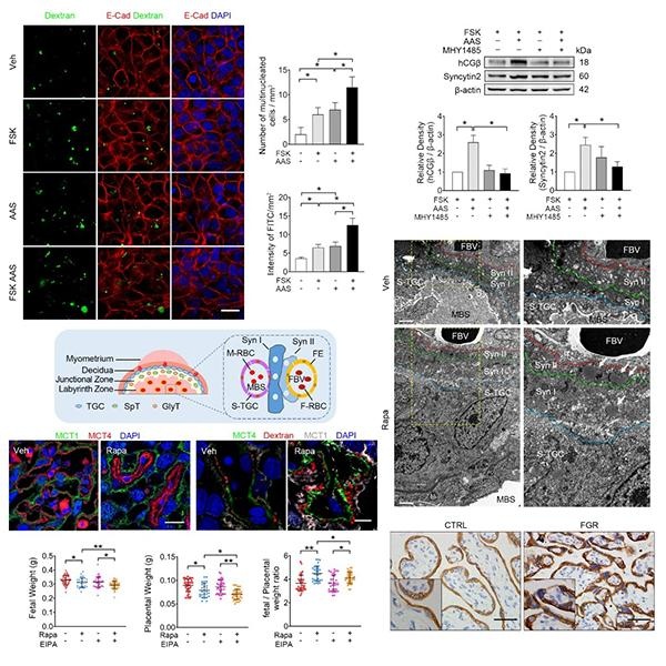 动物所等揭示胎盘滋养层细胞应对妊娠期营养压力的机制