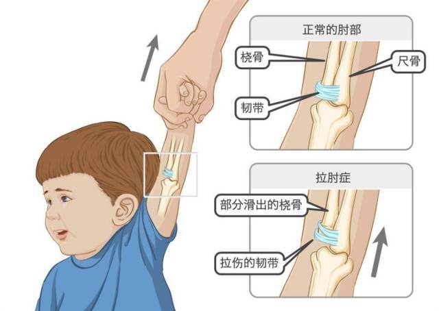 援非日记27|3岁非洲小孩脱臼哭闹不止,中国医生有妙招!