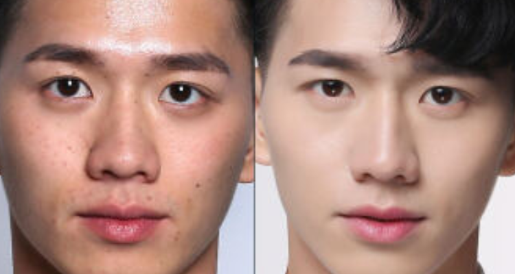 男生快速变白的方法