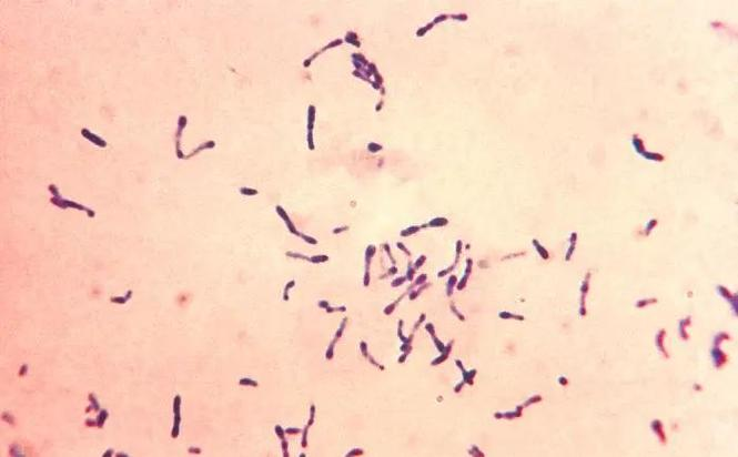 趋磁细菌在铅污染治理中的新突破与应用前景