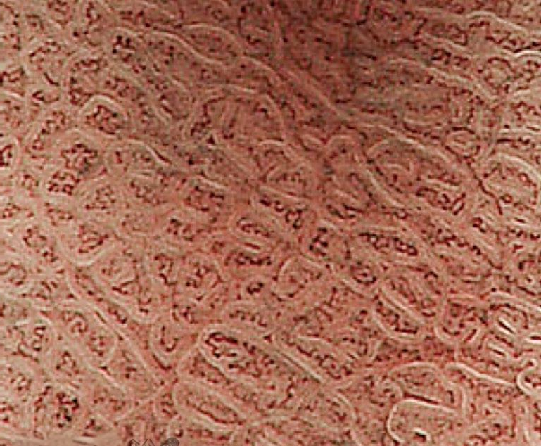 医学美图:探索胃的组织解剖与内镜图像特征