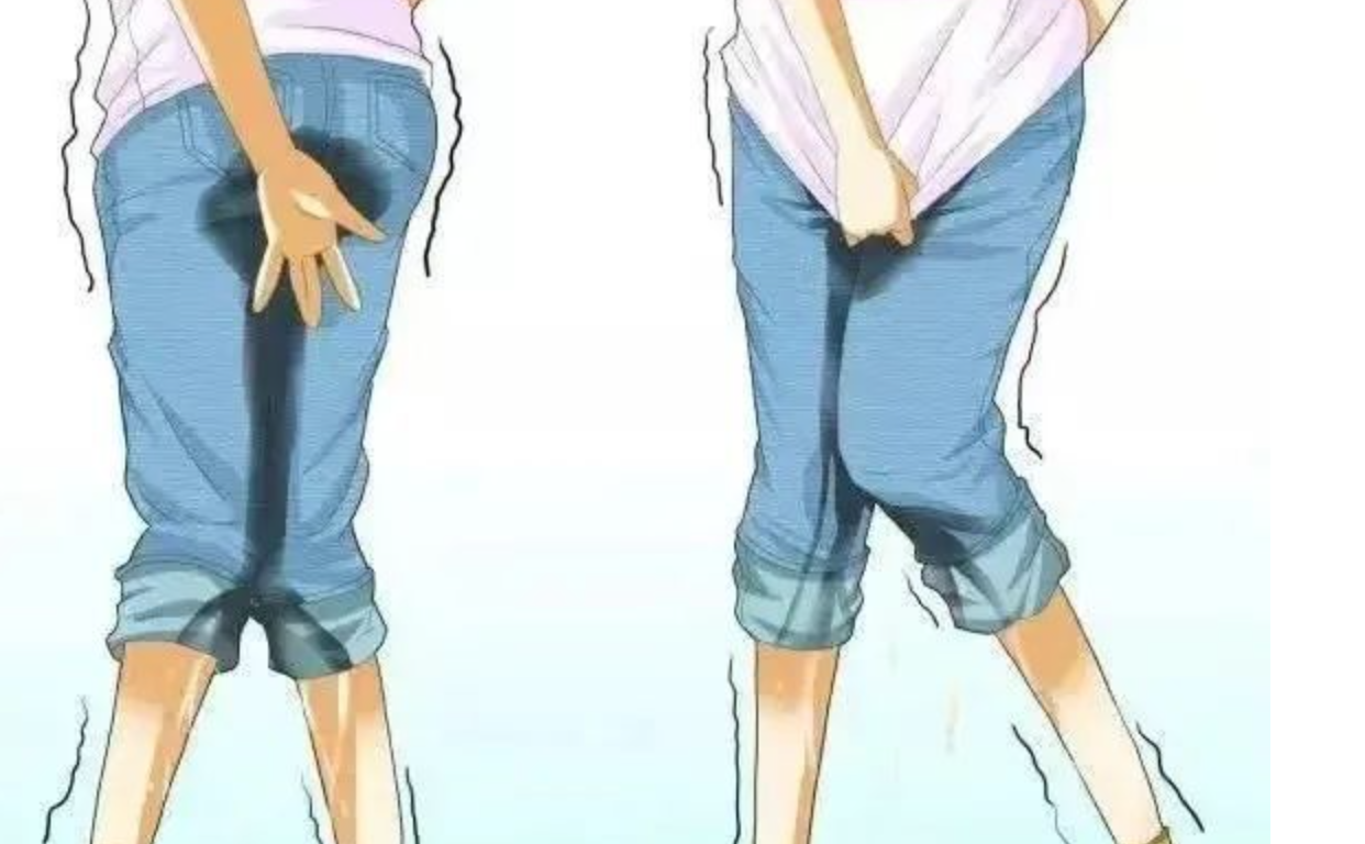 这位小女生大便失禁多年,是什么病因?看似复杂,治疗很简单