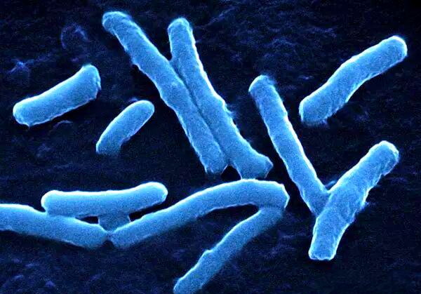 梭状芽孢杆菌家族:从有害到有益的微生物旅程