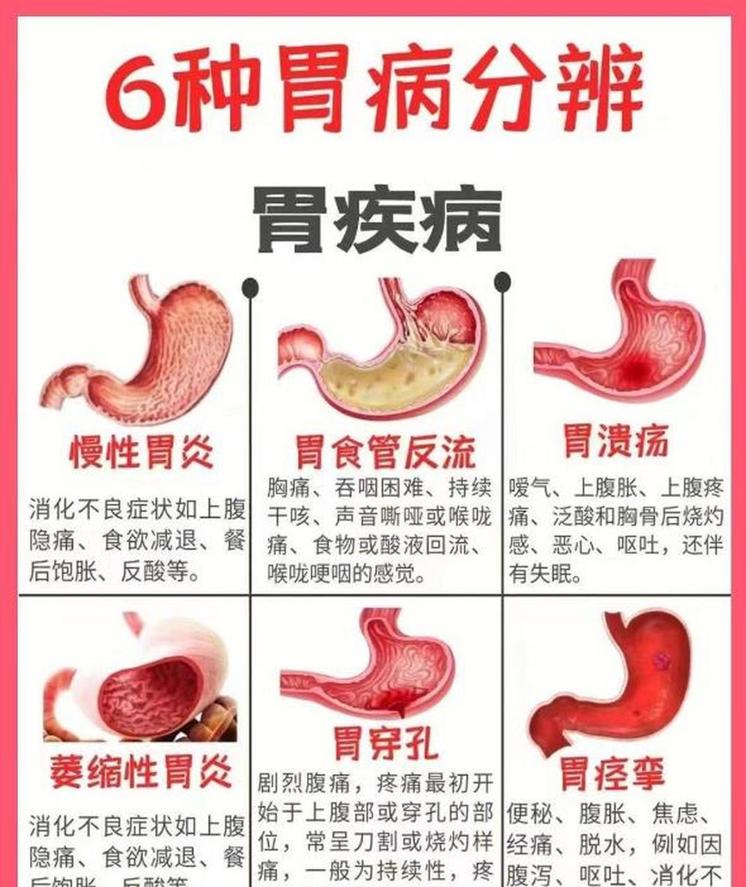 健康2023##胃病##脾胃##中医