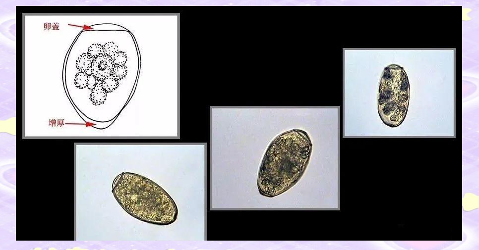 揭秘常见寄生虫卵的形态与大小