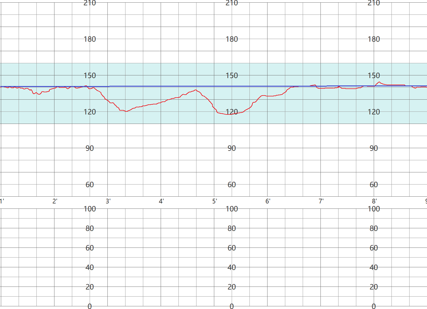 (一)正弦波形正弦波形的主要特征是,在没有胎动和加速反应的情况下,胎