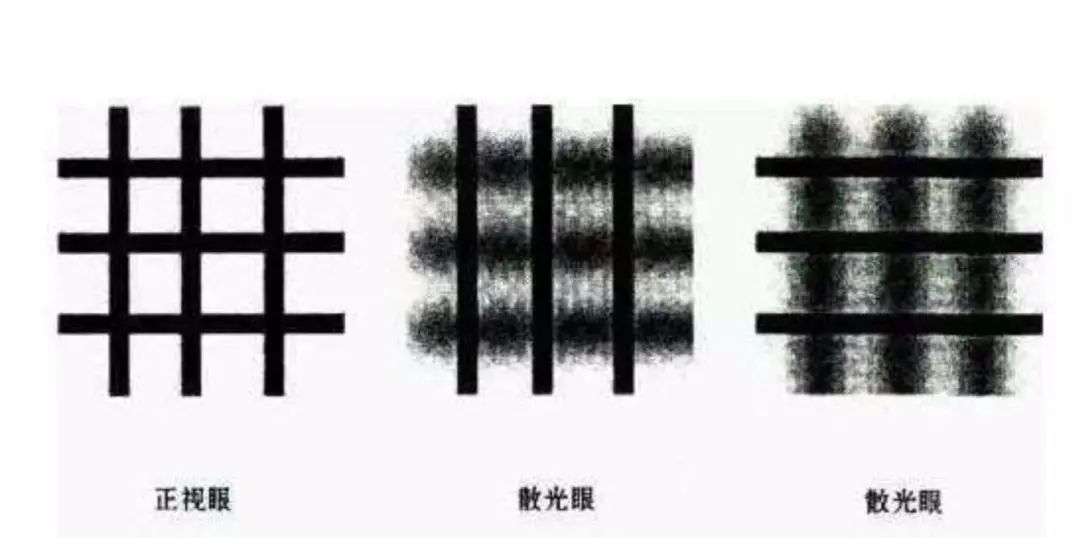 关于散光的危害,新视力自然疗愈为你解答!