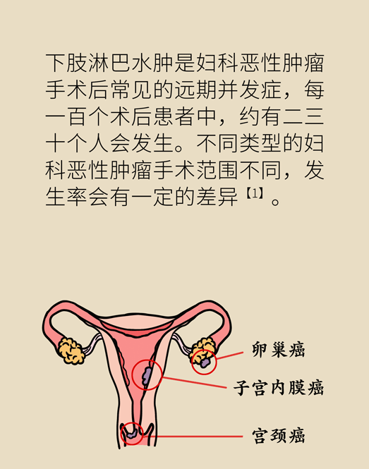 子宫内膜癌能治愈吗图片