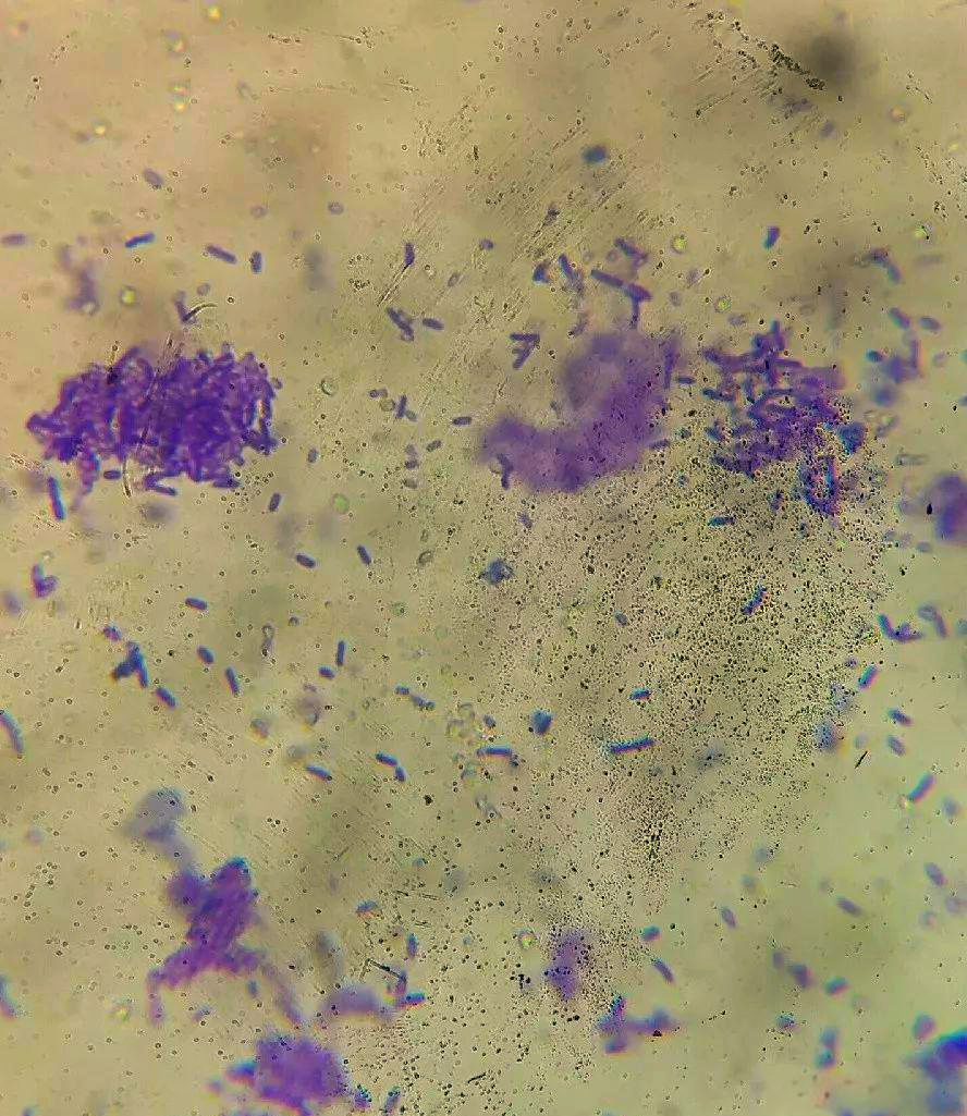 显微镜下的枯草芽孢杆菌世界通过显微镜的放大,我们可以一探究竟,看看