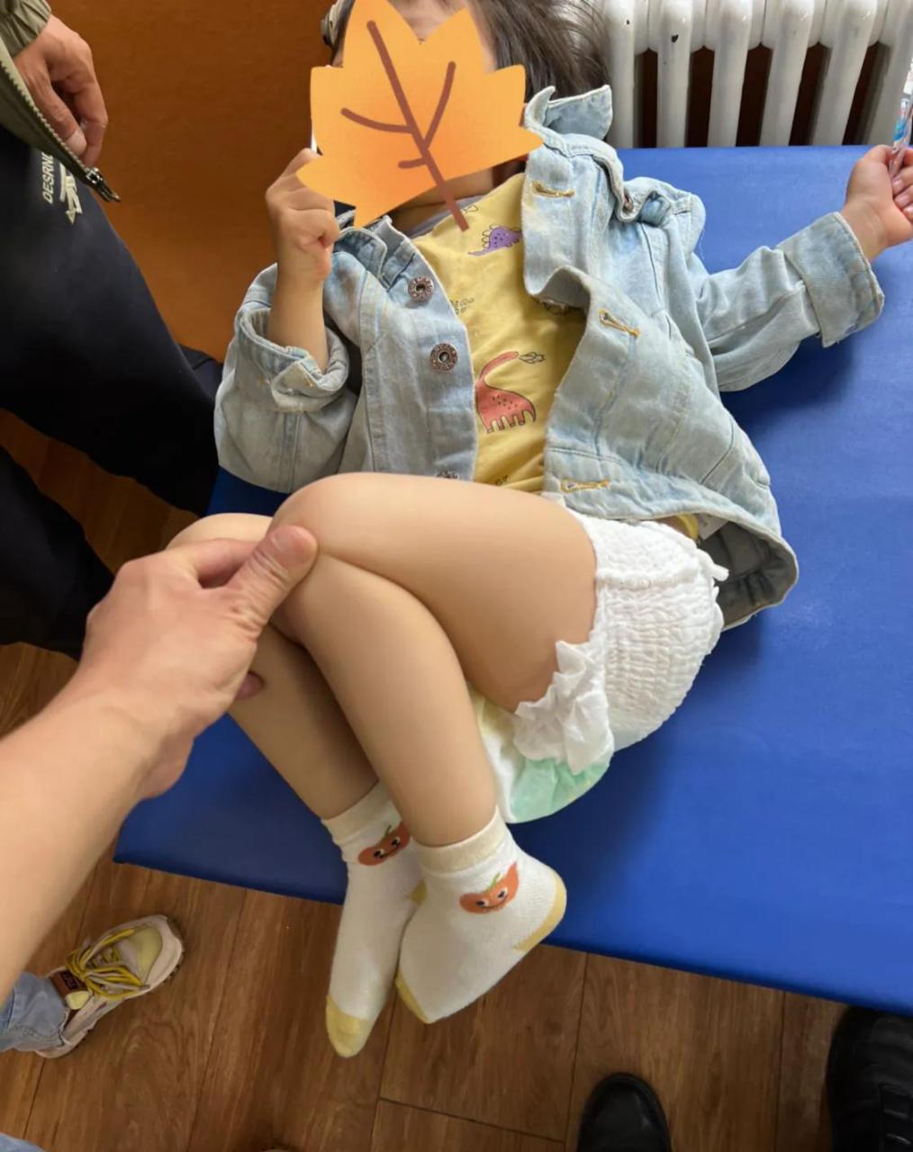 这睡姿就是痉挛性脑瘫小孩,肌张力增高容易复发的原因之一!