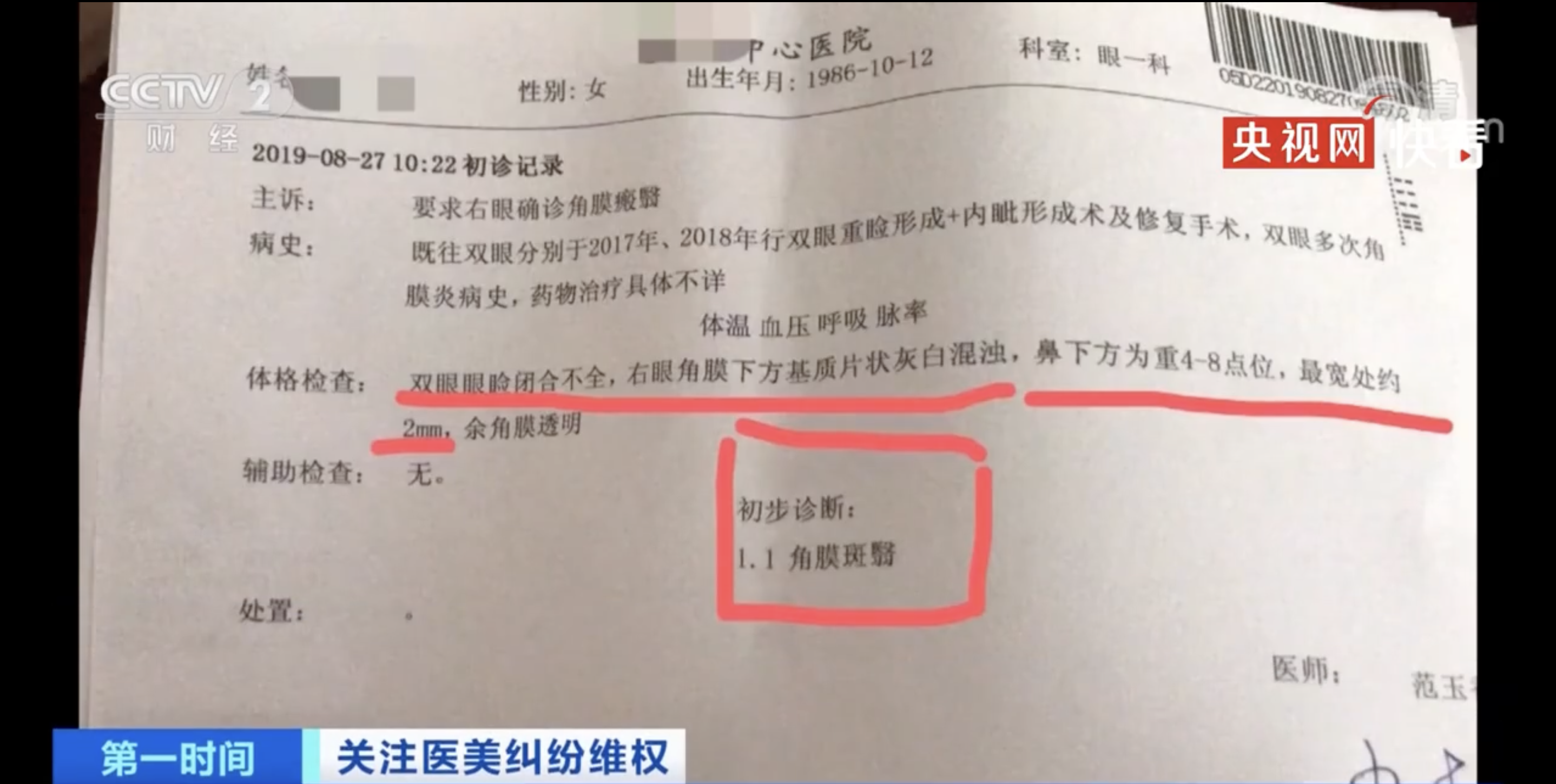 女子花近8万整容整成9级伤残,当事人:眼睛很痛不能出门,在家必须拉