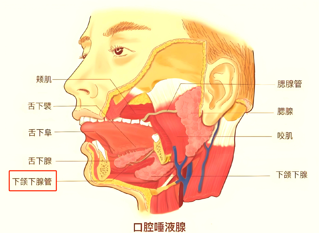 下颌下腺导管结石的成因与治疗方案深度解析