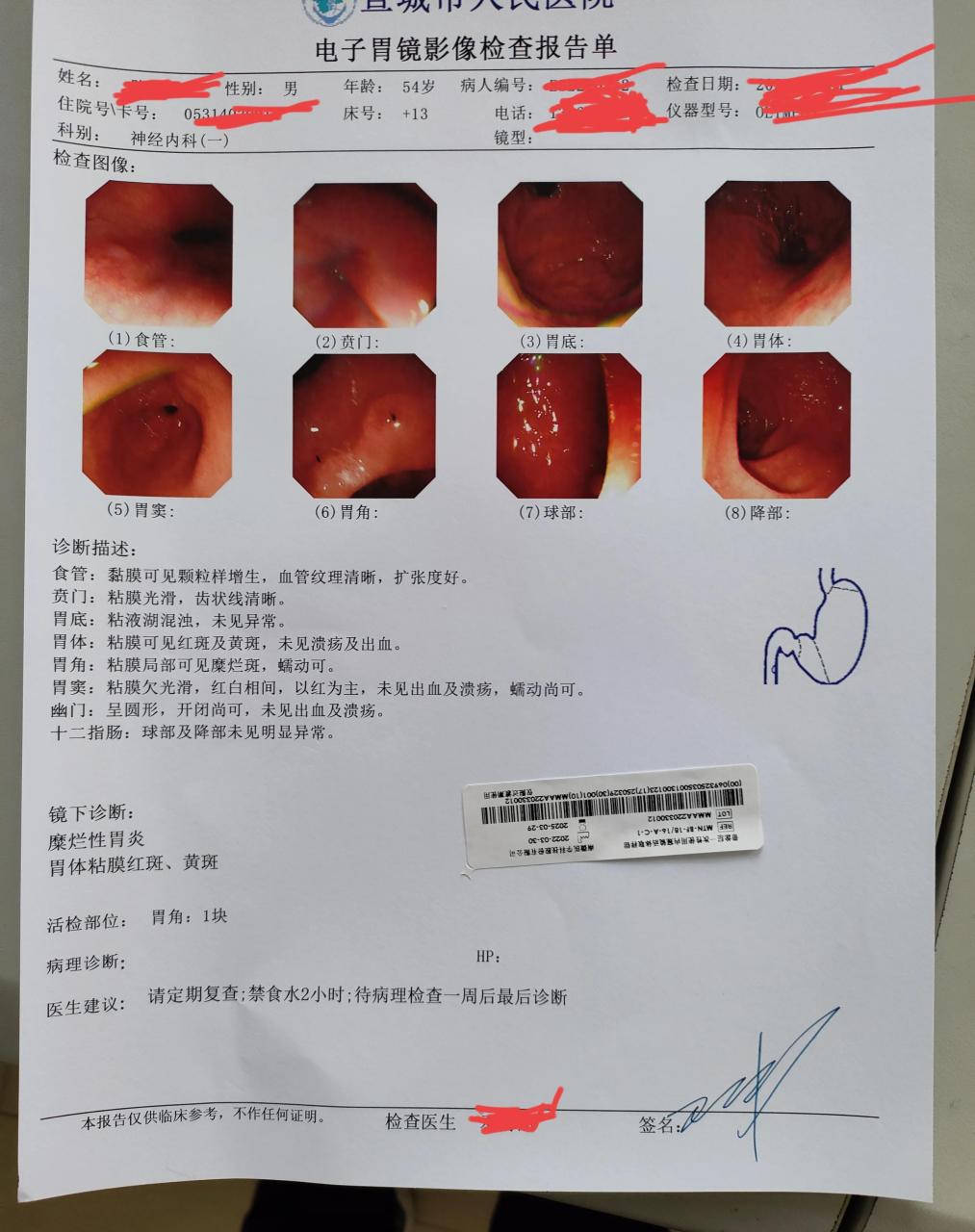 咨询请教各位网友: 这是我胃镜检查报告和病理诊断结果,一年前c14吹气