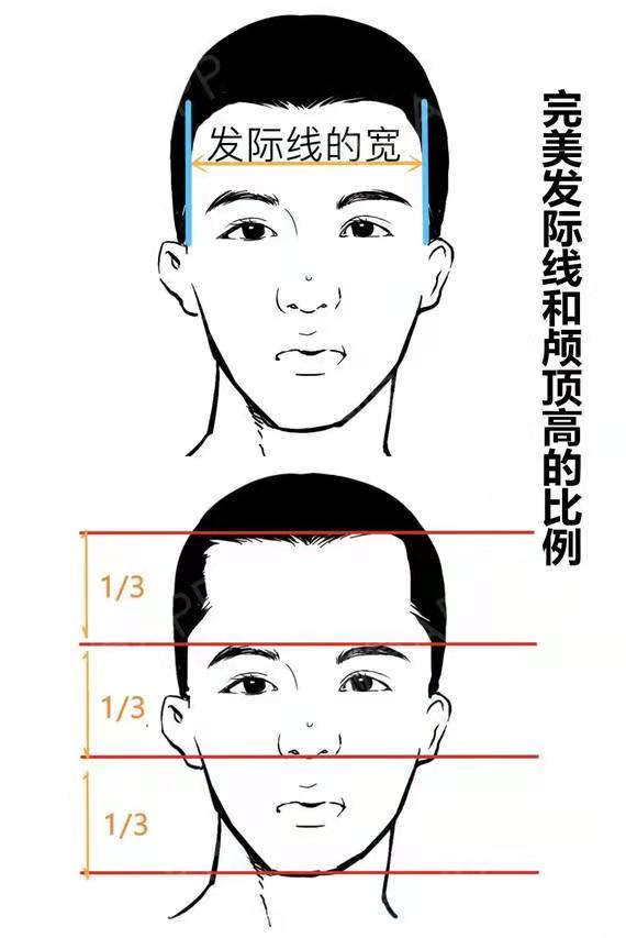 揭秘植发医生设计男性发际线考虑的几个问题?