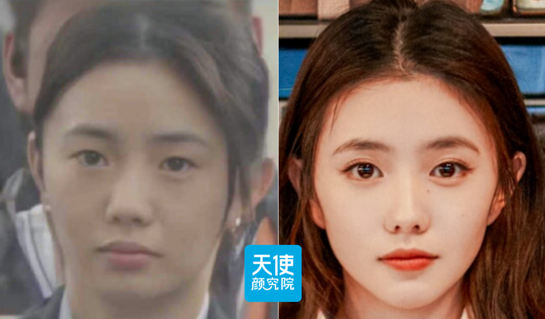 刘浩存最新素颜照……她是睡觉都贴双眼皮贴吧?