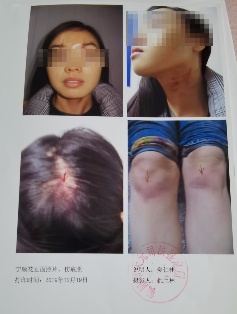 女子5年4次起诉离婚均遭驳回,怎么证明"感情完全破裂"?律师有话说