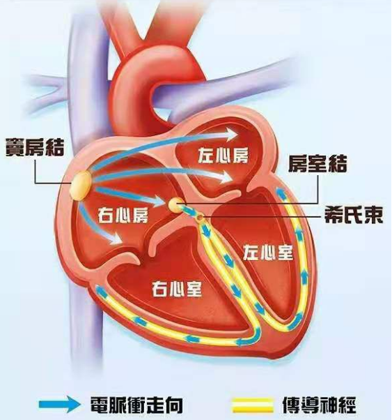 窦性心律不齐图解图片