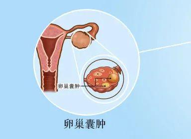 12岁女孩条毽子操剧烈腹痛