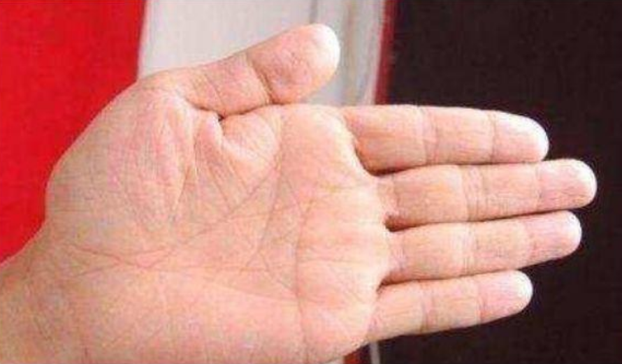 肝脏好的人,手上通常会有4个"标志",不妨对照自查下