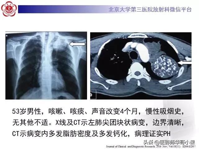 北医三院挂号指引CT加急-北医三院挂号指引ct加急要多久 