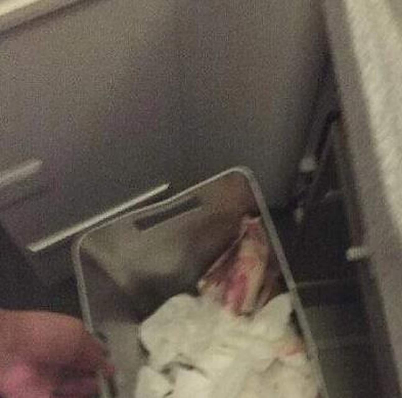 今天去姨妈家看望,发现她厕所的纸篓里,有带血的纸巾,好像是当姨妈巾