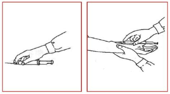 「高频考点」护士资格考试高频考点梳理:皮内注射法