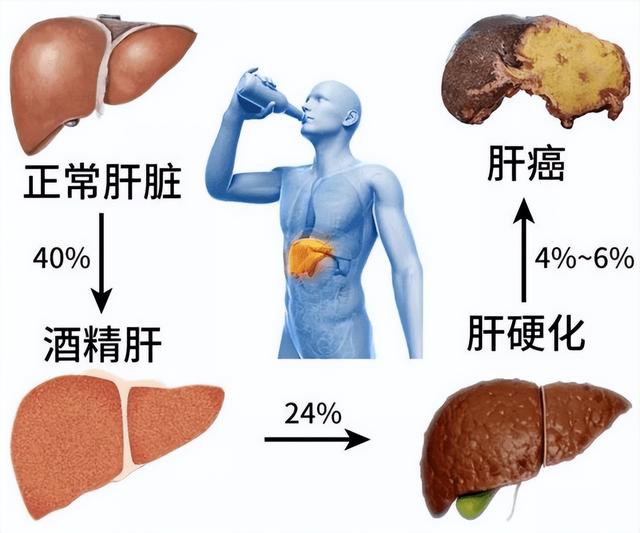 喝酒对肝的损伤有哪些误区?天天喝酒和偶尔喝酒哪个更伤肝?