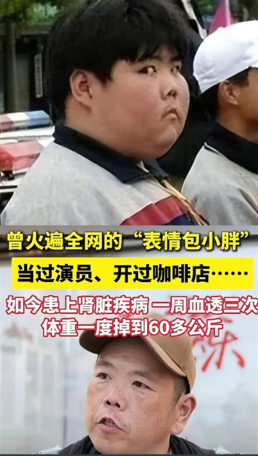 网红小胖一周透析3次：曾因表情包爆火 自称要做嘚瑟的病秧子