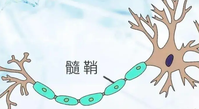 髓鞘病变累及的神经髓鞘导致出现脱髓鞘的改变