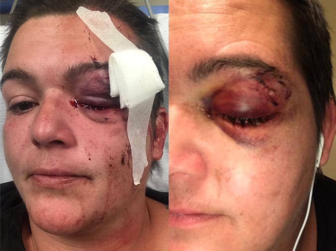 蓬佩奥们请回答:这就是美式"言论自由"?