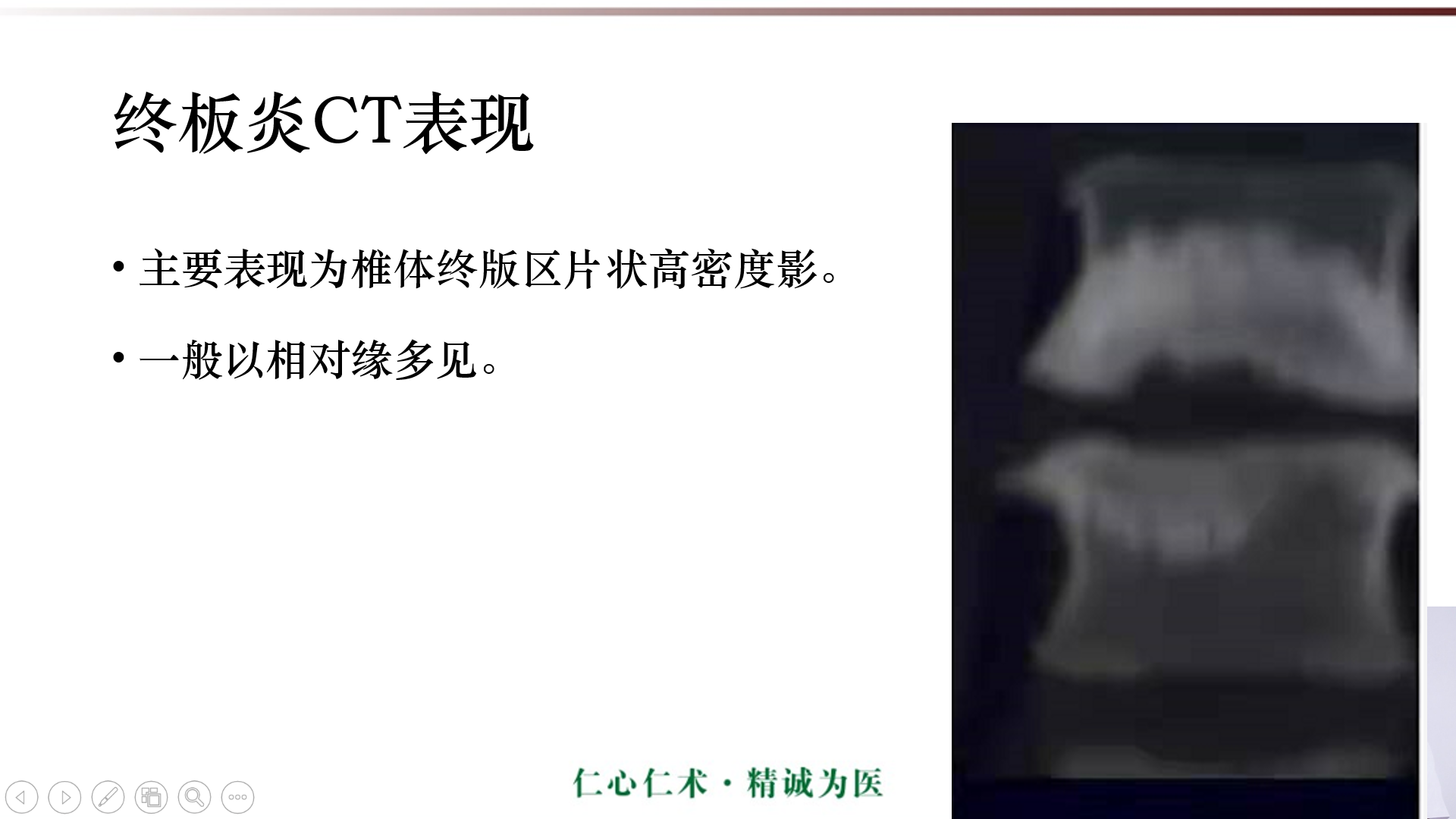 許莫氏結節及終板炎影像診斷