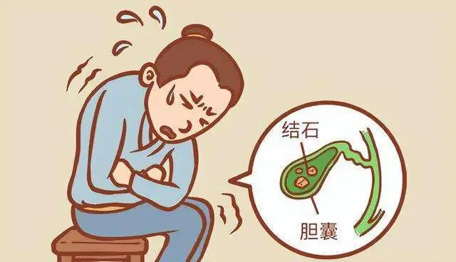 百姓健康 | 养成良好习惯,远离胆道疾病