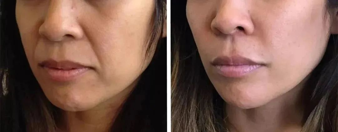 气血不足,脸蜡黄?女人常吃它,养出红润好气色