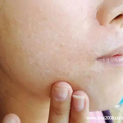 脸上搓出白泥是角质吗 baijiahao.baidu.com