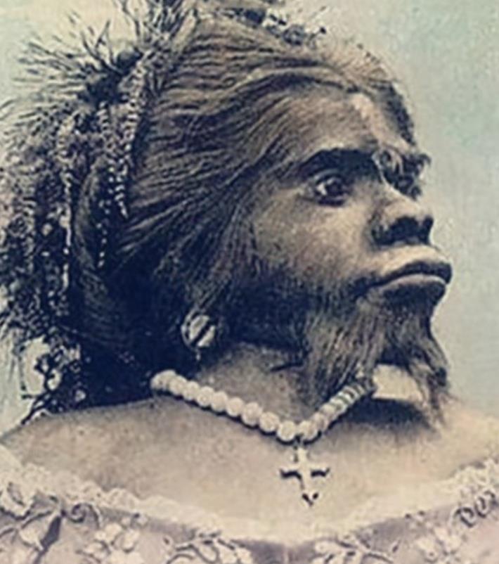 墨西哥女孩儿朱丽亚:返祖现象,体毛浓密,有钱人购买