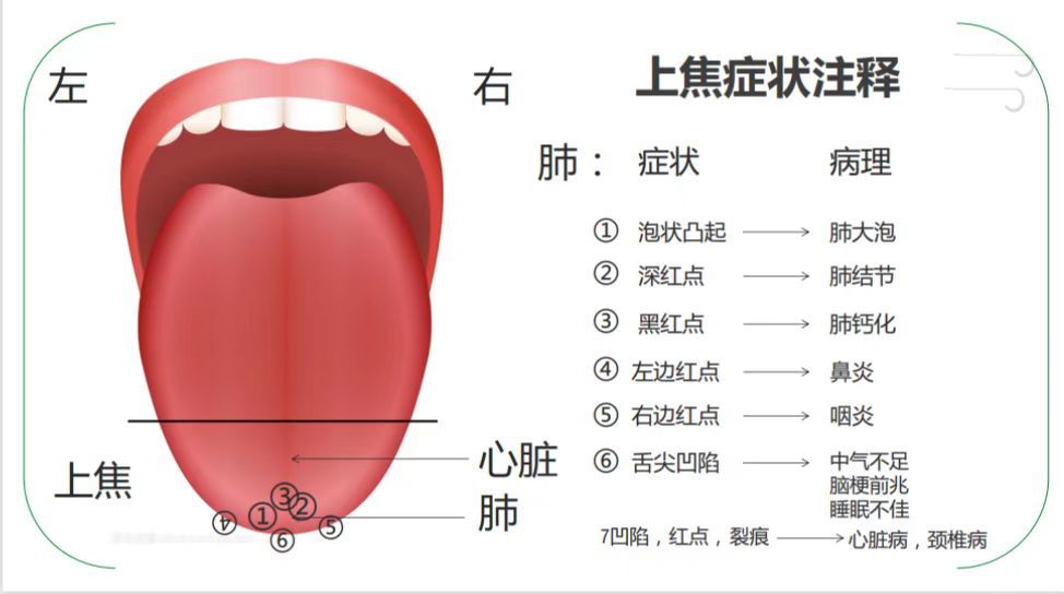 中医特色舌诊分享——基础概论