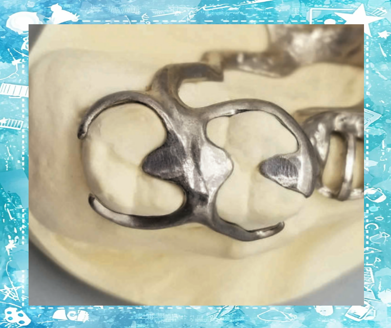 其独特之处在于,卡环的主体部分并不伸出至𬌗支