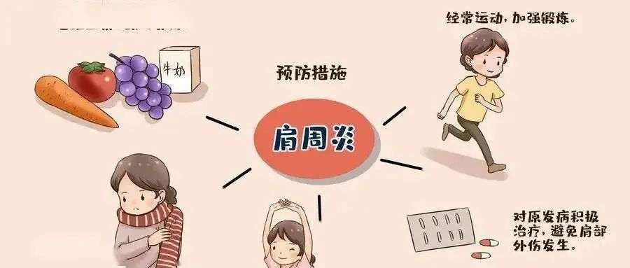 【浦人医·健康】健康知识月月讲之肩周炎的防治科普