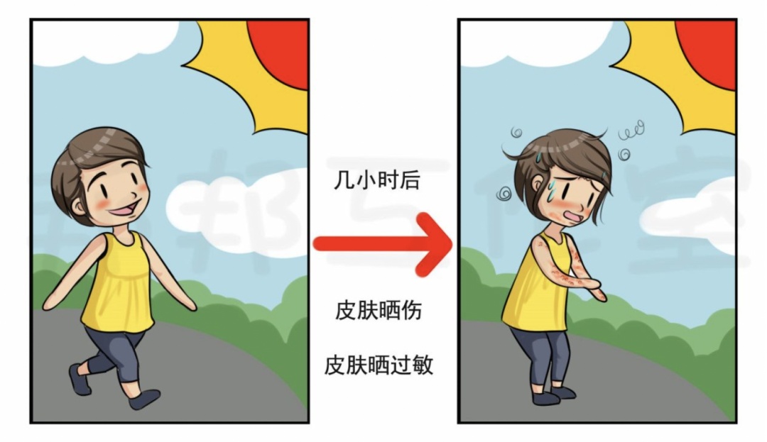 炎炎夏日,谨防这种皮肤病来扰