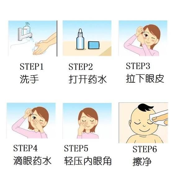 首先,我们来示范滴眼药水的正确