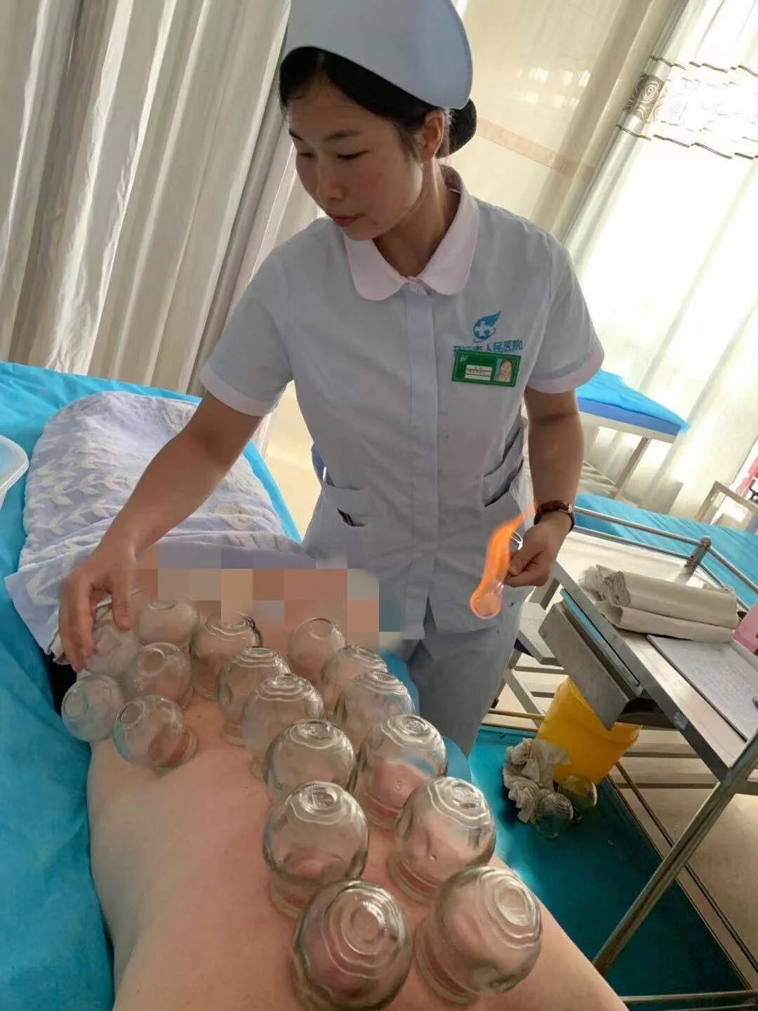 你所不知道的拔罐疗法——平衡火罐