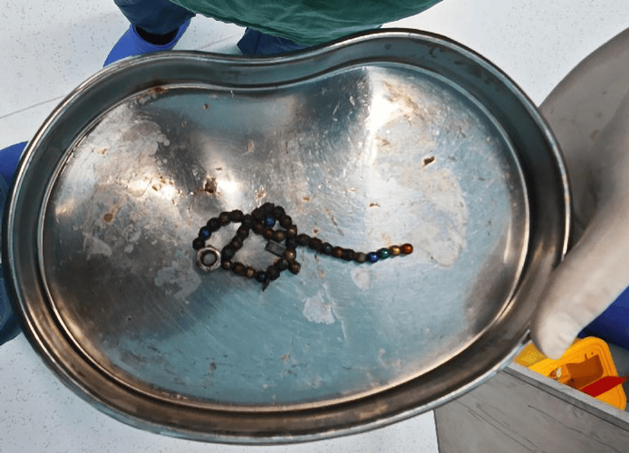 磁力珠子的危害_磁力珠子的危害是什么（磁力珠有什么危害）